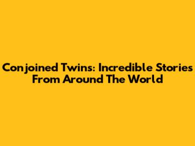 Conjoined Twins: Incredible Stories From Around The World