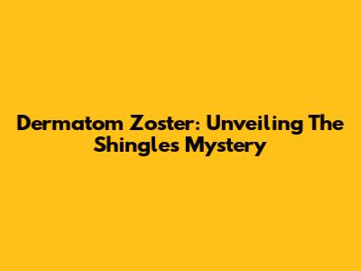 Dermatom Zoster: Unveiling The Shingles Mystery