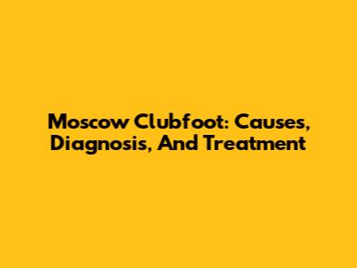 Moscow Clubfoot: Causes, Diagnosis, And Treatment