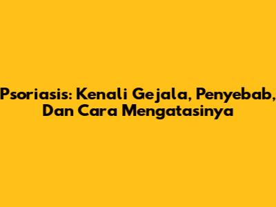 Psoriasis: Kenali Gejala, Penyebab, Dan Cara Mengatasinya