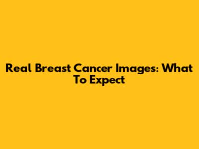 Real Breast Cancer Images: What To Expect