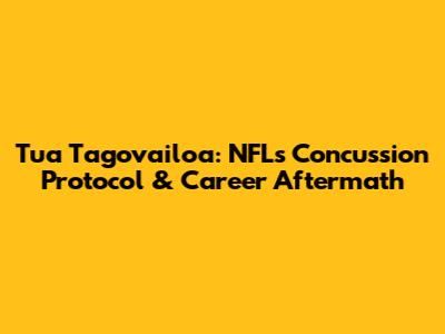 Tua Tagovailoa: NFL's Concussion Protocol & Career Aftermath