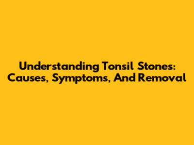 Understanding Tonsil Stones: Causes, Symptoms, And Removal